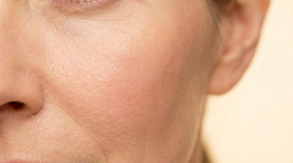 Close-up of clear, even-toned facial skin without redness